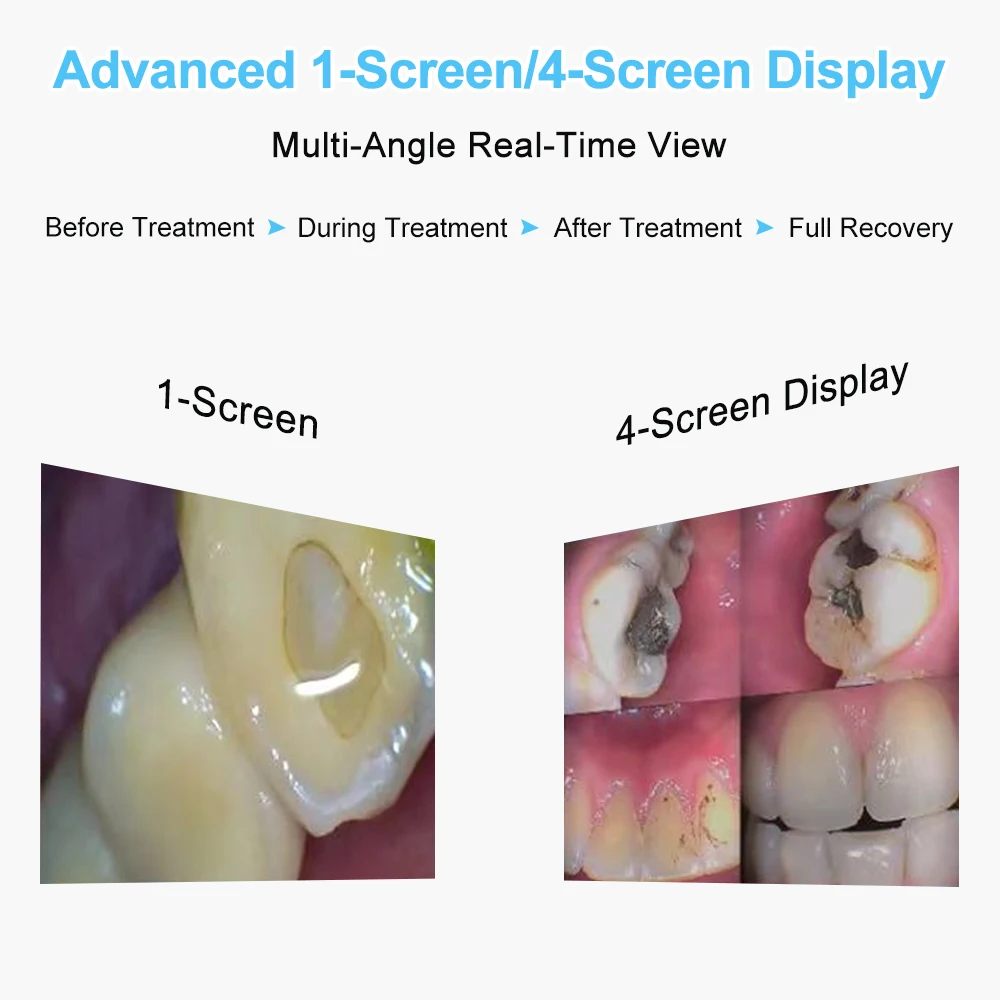 13 Megapixel Dental Intraoralkamera Wifi Wireless Intra Oral Tooth HD 1080P 6 Objektiv Autofokus Endoskop für Android I0S Windows