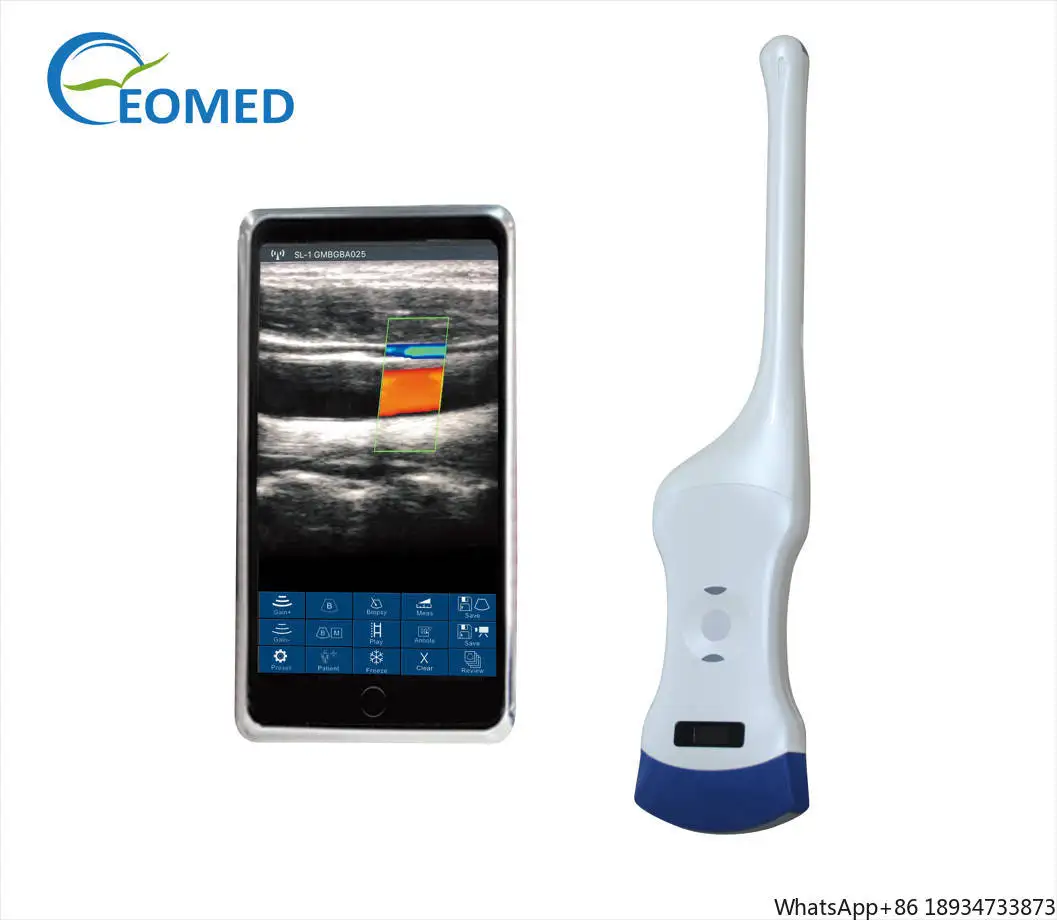 Color Doppler Wireless Ultrasound Dual Head Ultrasound Probe 128E Convex/Transvaginal 2 in 1 DCU19D