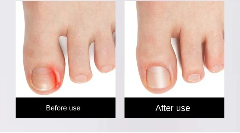 Anti-Splash Nail Clippers Single Nail Clipper Thick Hard Special Nail Trimmer Large Size Household Thick Nails Protable Newest