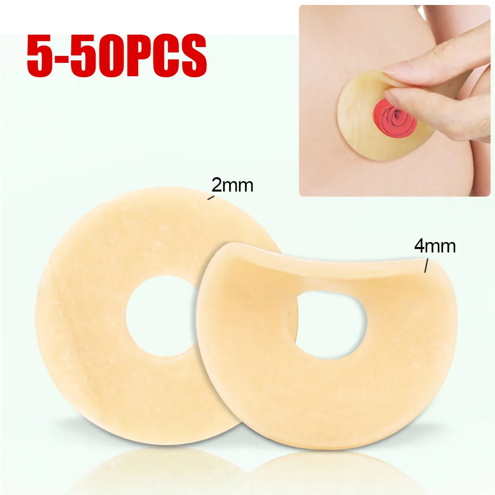 2/4mm Colostomy Bag Anti-leak Ring Paste Stoma Bags Supplies Protective Barrier Rings Ostomy Bag Leak Proof Sealing Sticker