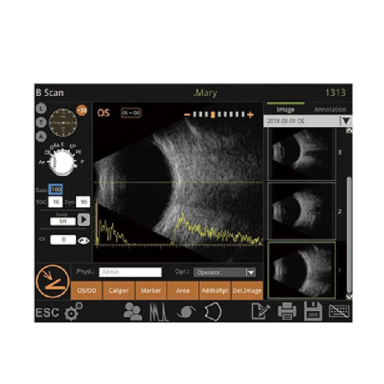 InnoVue Opto A/B Scan Function for Accurate Ocular Biometry Portable Ophthalmic Ultrasound OAB-1000