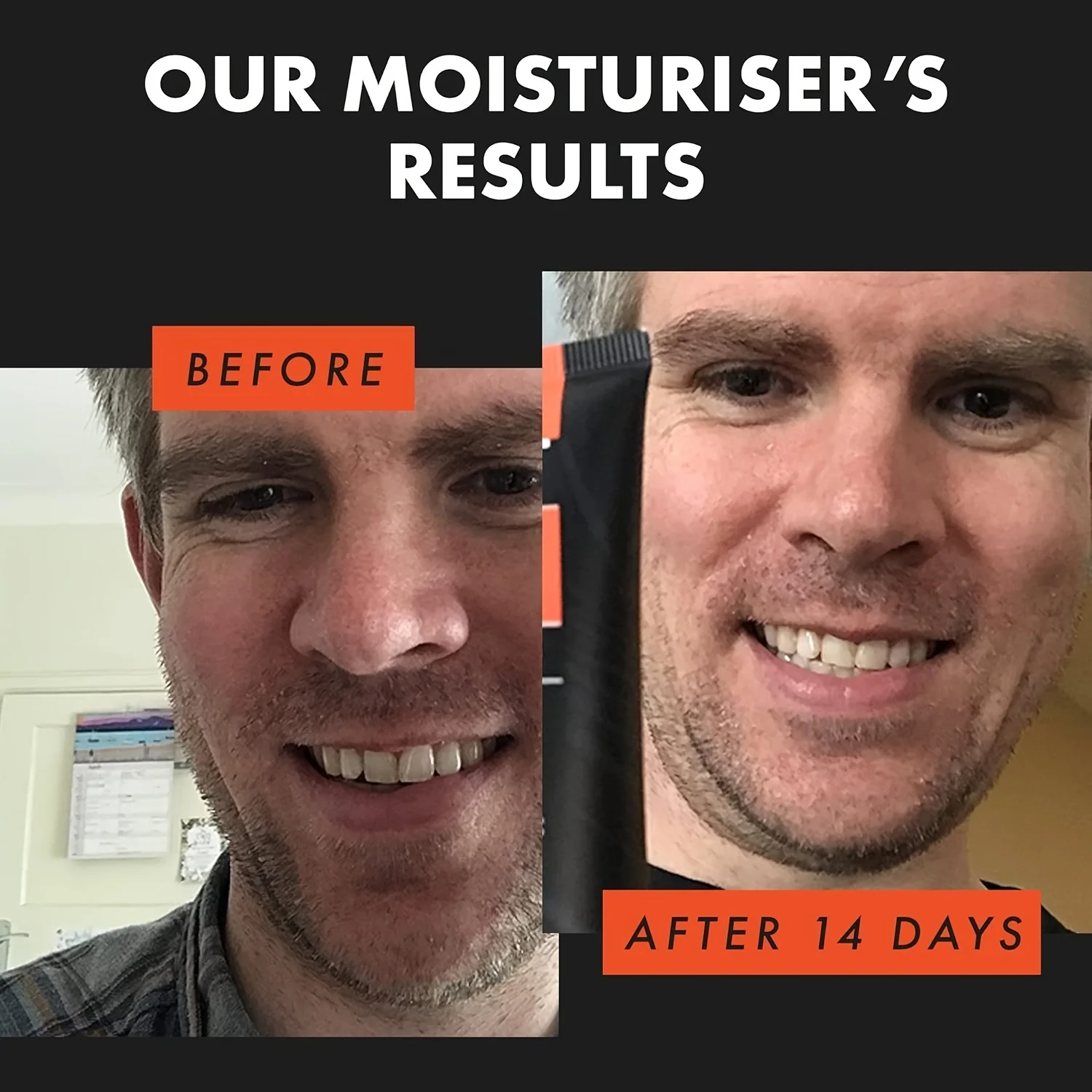 Mens Face Moisturiser for Men with Shea Oil Vitamin E Hyaluronic Acid