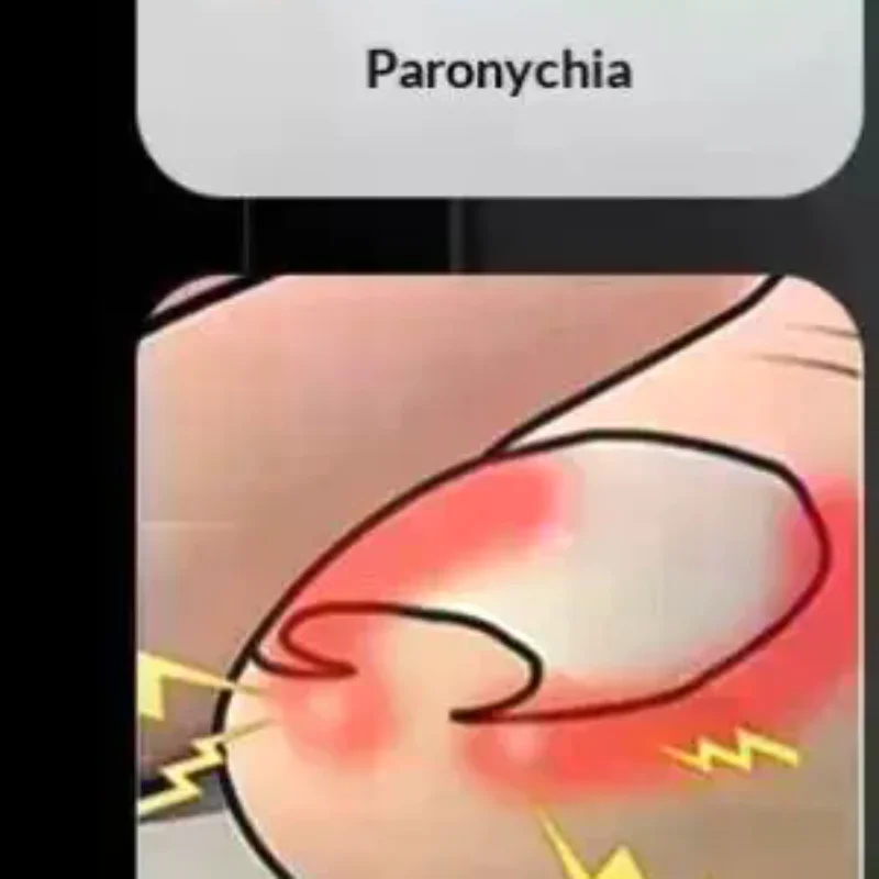 Coupe-ongles à lame droite, coupe-ongles épais incarnés, dissolvant de strass, outils de manucure, 1 pièce