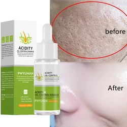 Pore Shrinking Serum Face Removing Large Pores Tightening Repairing Facial Pore Minimizing Essence Moisturizing Skin Care Beauty