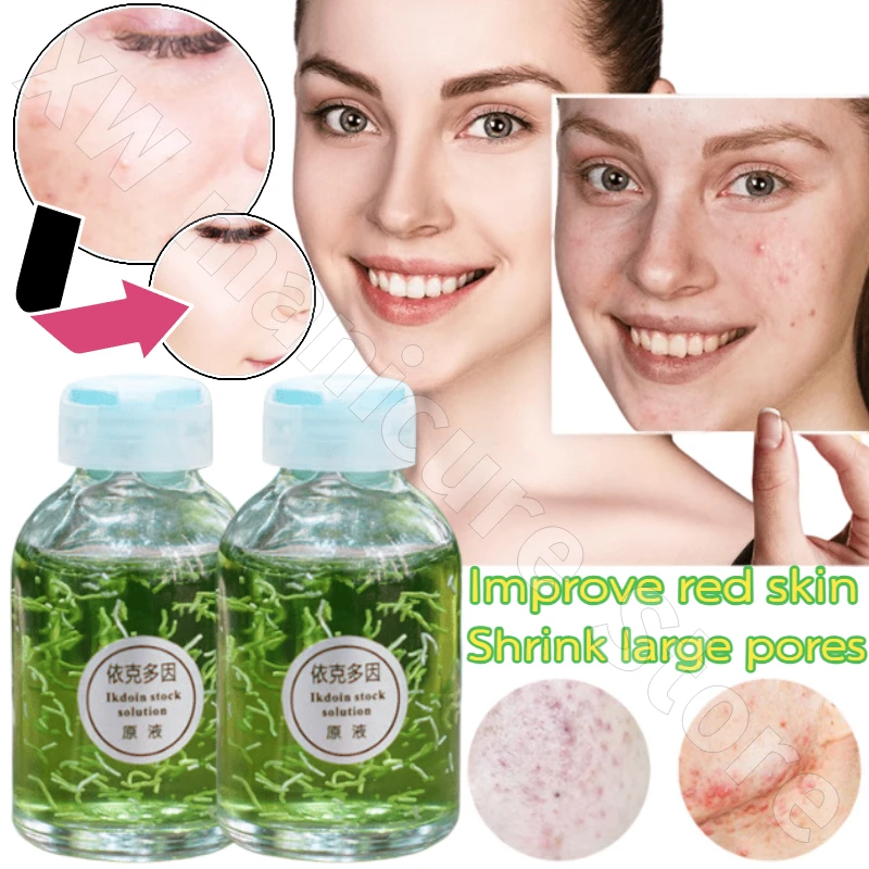

Facial Essence 30ml Repairs Damaged Skin Barrier, Improves Redness, Shrinks Large Pores and Is Suitable for Sensitive Skin