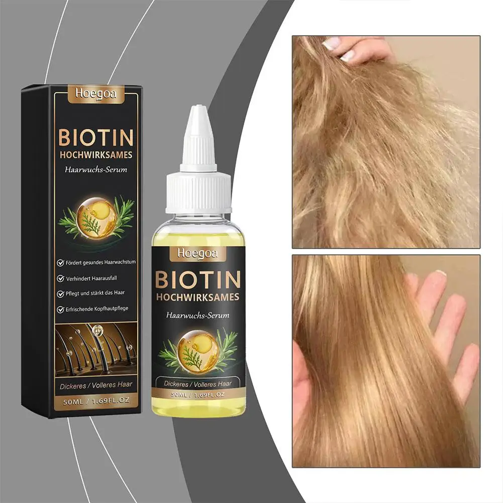 30/50ml Biotin Hair Serum Rosemary And Ginger Hair Growth Oil For Men And Women,Help Grow Healthy,Strong Hair Care Essential Oil