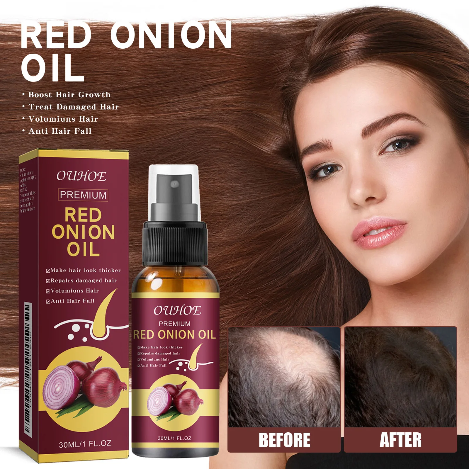 Onion dense hair essential oil Promote hair growth strong anti-loss solid hair moisturizing care spray