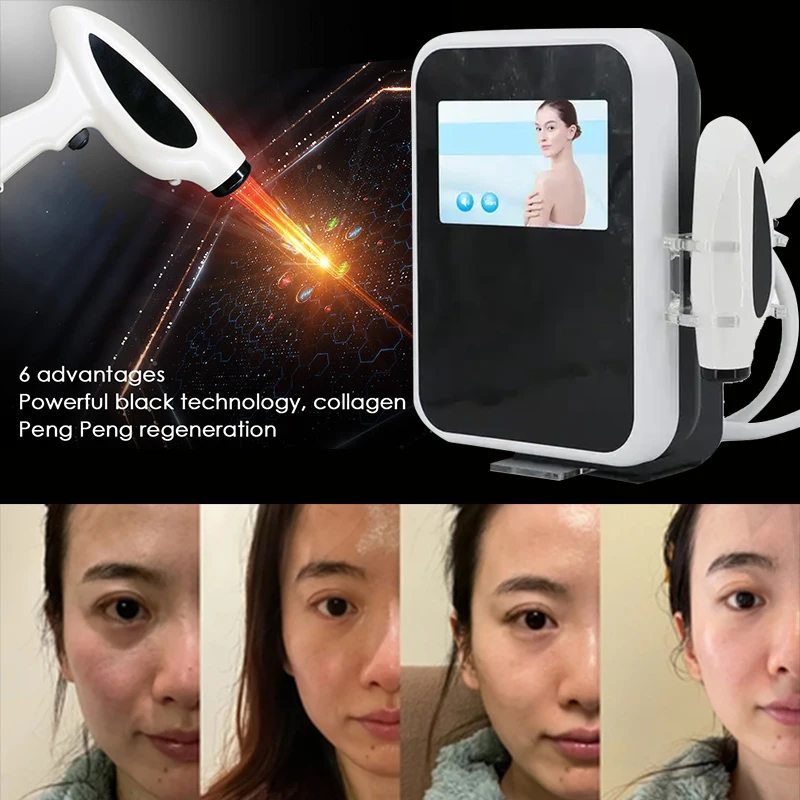 RF Machine for Facial Lifting Skin Lifting Anti Wrinkle Neck Skin Tightening Radio Frequency Smas Lifting Professional Beauty Eq