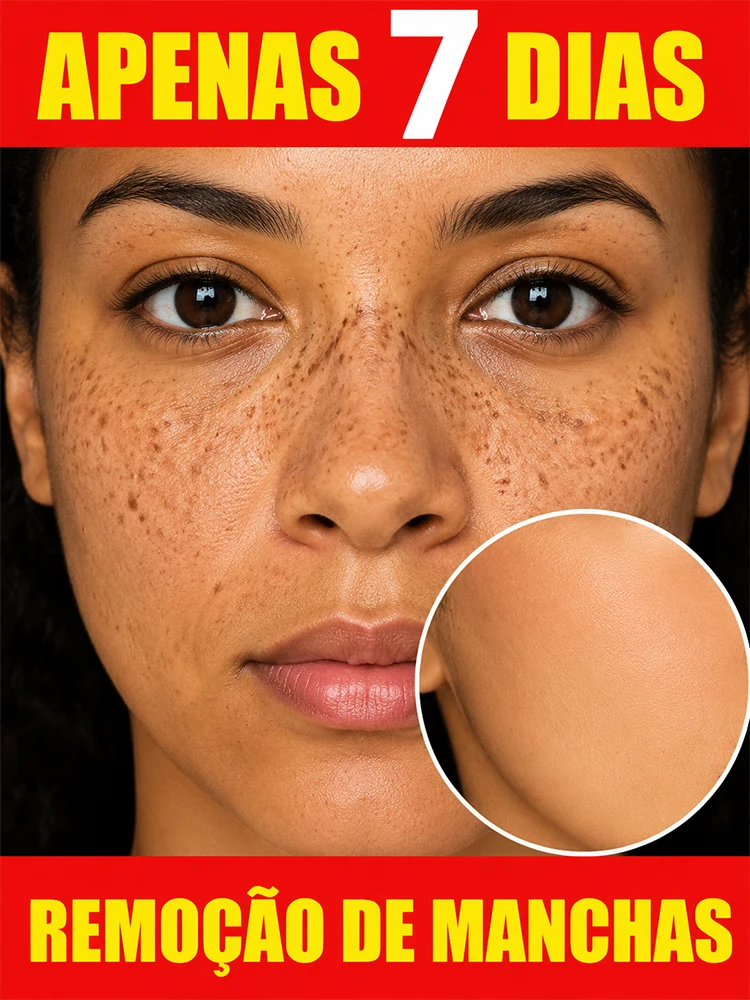 Professional Dark Spot Fade Serum Melanin Restrain Anti Pigmentation Sun Spot Remove Gloss Whitening