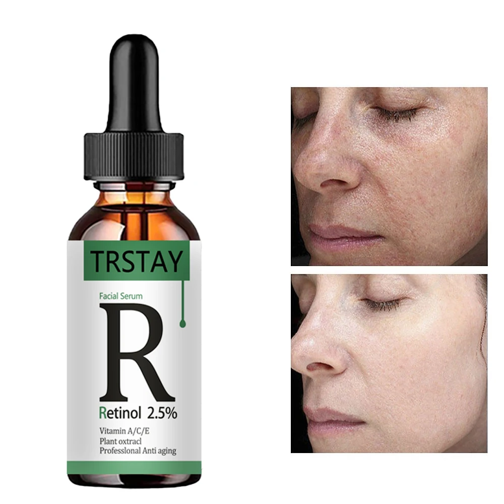 retinol 2.5% vitamin C/A facial essence reduces fine lines, tightens skin, and improves damaged skin