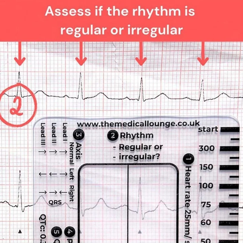 ECG 7 Step Ruler ECG Ruler Plastic Ruler Measuring Tool For ECG/EKG Interpretation Easy-To-Carry With 1 Protect Sheath