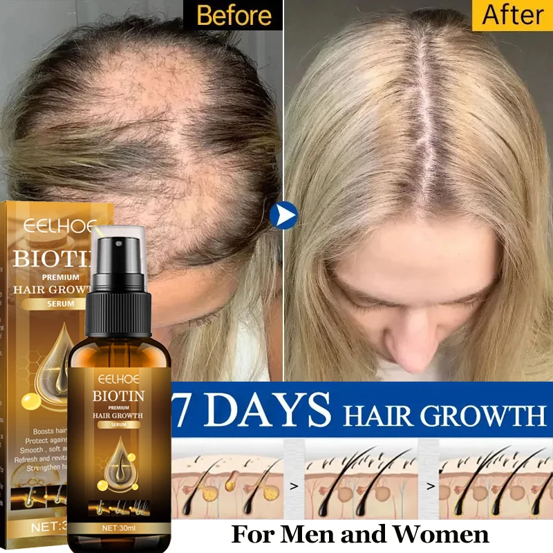 Biotin Fast Hair Growth Products Anti Hair Loss Serum Spray Prevent Baldness Treatment Scalp Beard Beauty Hair Care Product