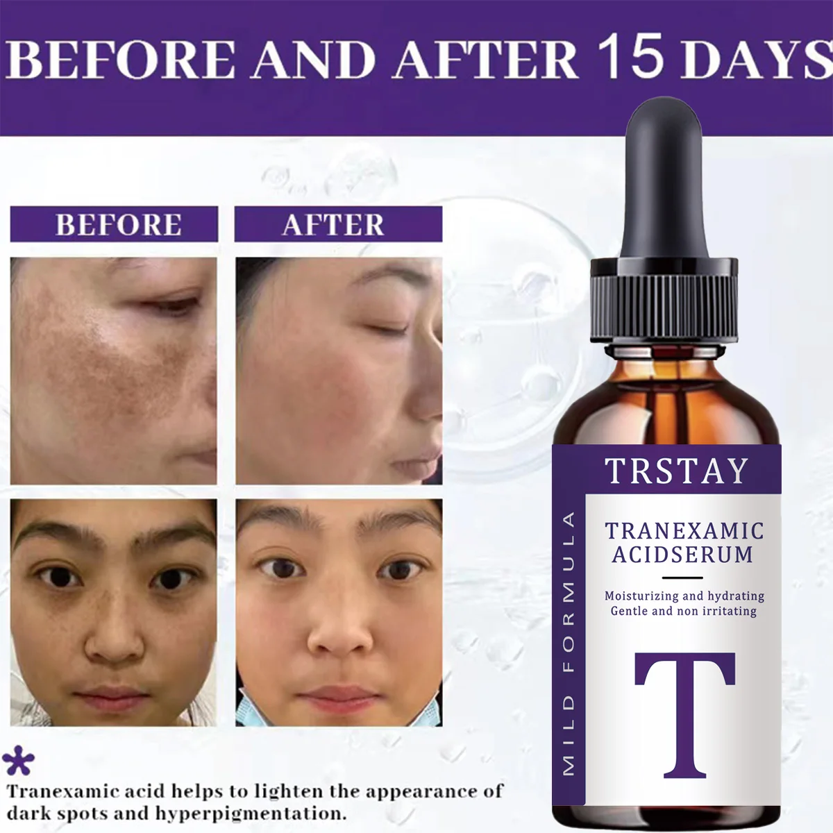 tranexamic acid essence, mild and non irritating, hydrating, nourishing, leaving skin soft and delicate