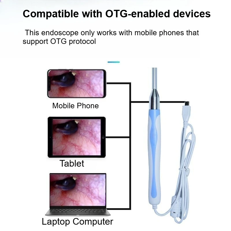 Portable Ear Wax Removal Camera USB Visual Otoscope Ear Cleaner HD Borescope Phone PC WiFi 6LED Rechargeable Kit Tool Inspection