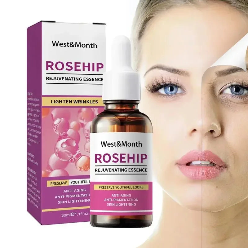 Suero de rosa mosqueta 30ml, aceite esencial de rosa mosqueta orgánica, aceite puro Natural para cara, suero antiarrugas antienvejecimiento, cuidado de la piel para mujeres