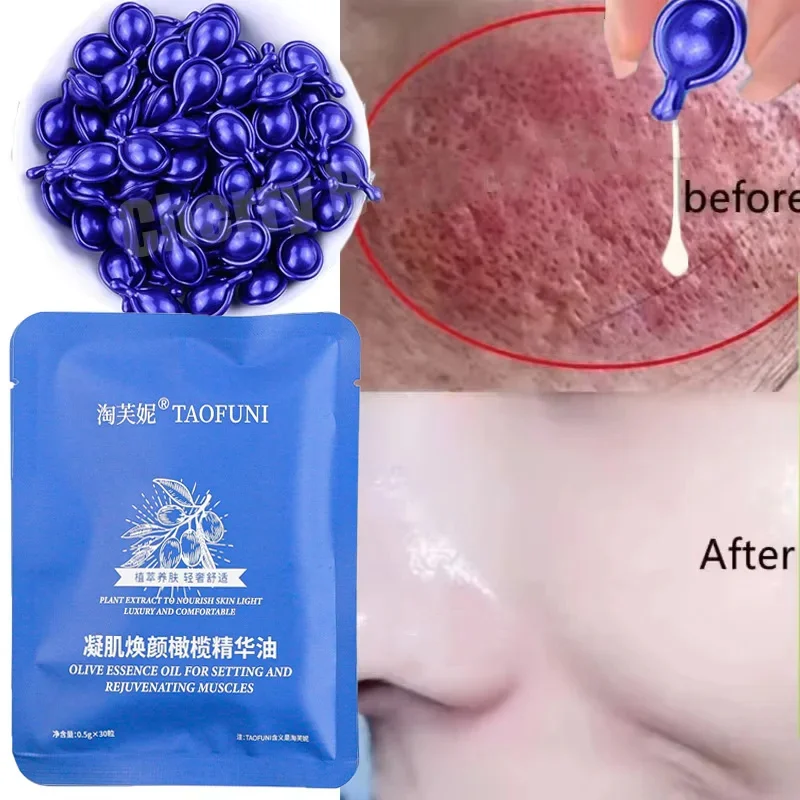 

Fast Repair Facial Redness Essential oil Soothing Red Blood Rosacea Improve Sensitive Skin Dryness Moisturizing Korean Cosmetics