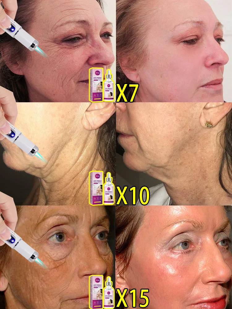 Electric Face  Anti-wrinkle face and neck beauty