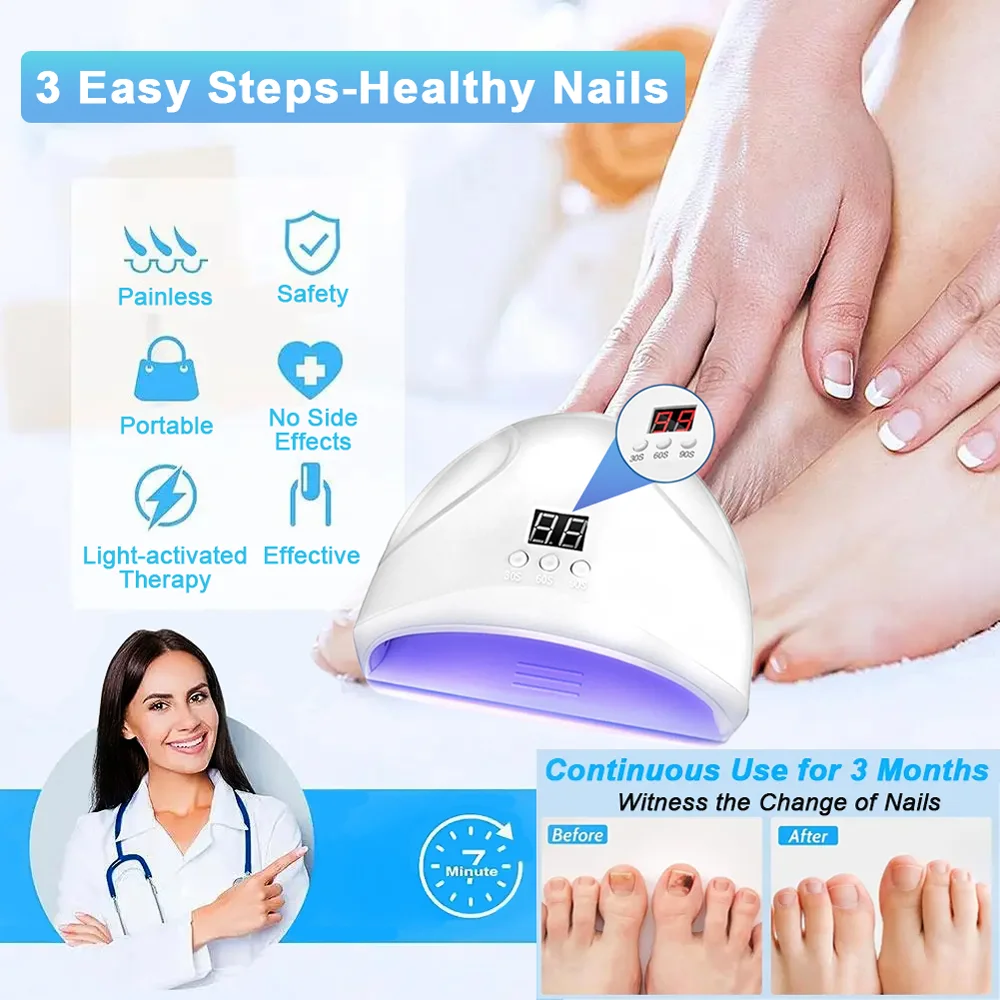 Appareil laser antifongique pour ongles incarnés, réparation rapide des champignons, onychomycose, ongle d'orteil, élimine les champignons des ongles, soin des pieds