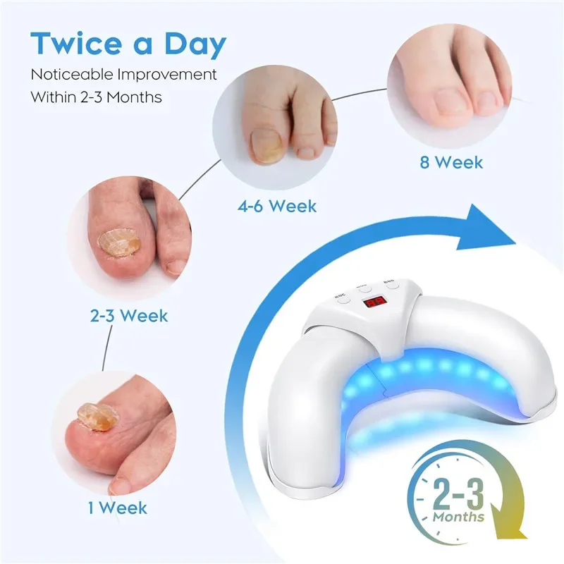 Nail Fungus Laser Treatment Device Repair Toenail Fingernail Fungus Treat Onychomycosis Therapy Cure Machine Effectively Remove