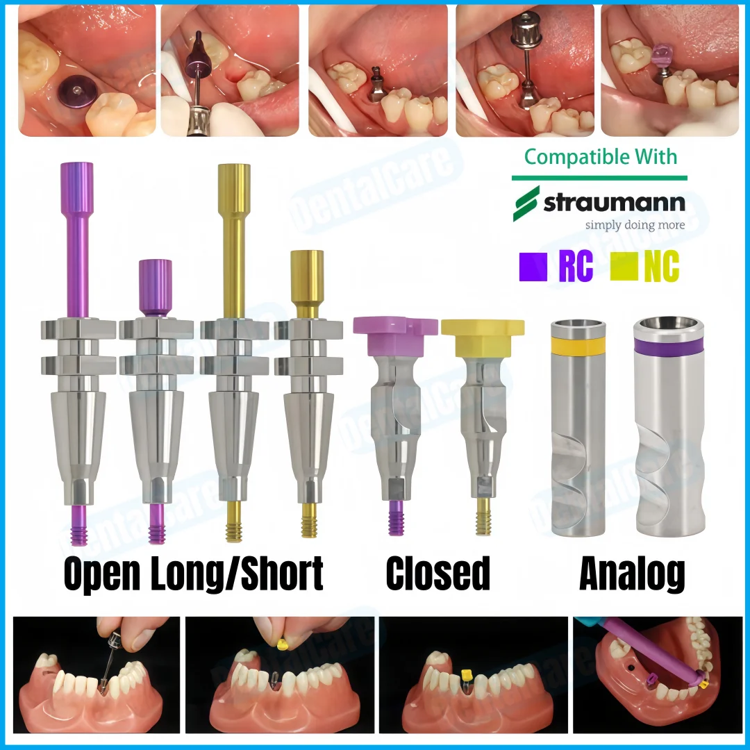 Dental ITI Impression Coping Transfer Tray Analog NC/RC Closed Open Fit Straumann