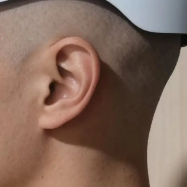 

Лазерная шапка-шлем для роста волос с красной светотерапией, устройство низкоинтенсивного света для лечения облысения в домашних условиях