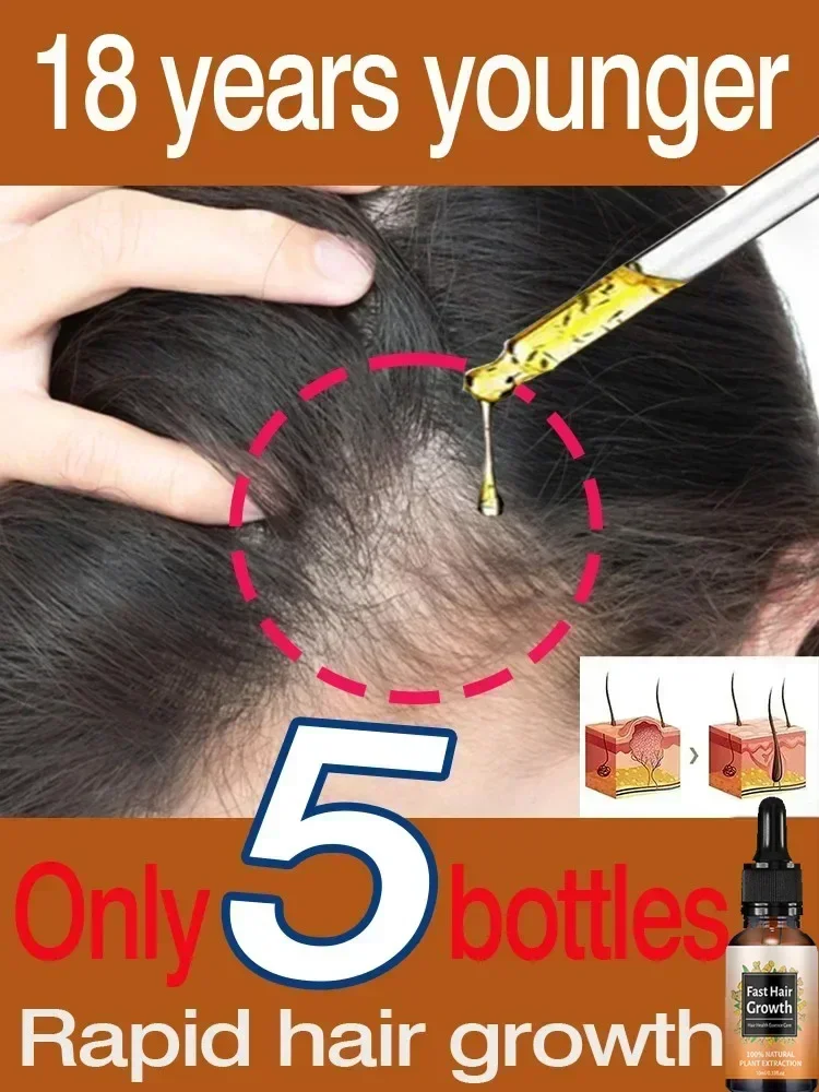 

Hair Growth Essential Oil. Effectively Repair Baldness and Hair Loss Symptoms