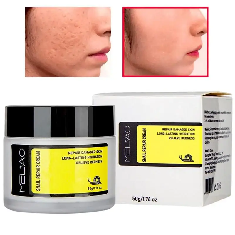 

Snail Face Cream Hyaluronic Acid Moisturizer Sodium Hyaluronate Cream 50g Nourishing Essence Day Cream For Moisturizing Face