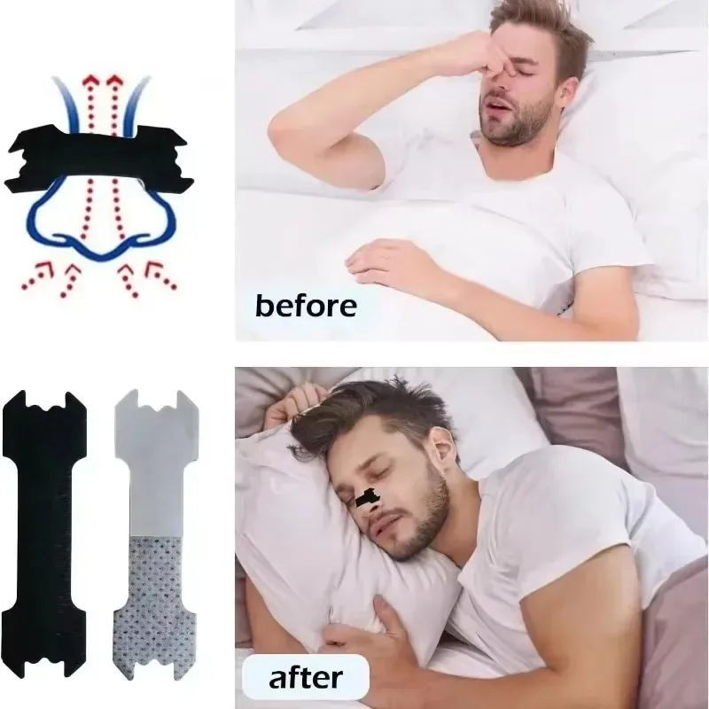 Anti Snoring Nose Patch Set Extra Strength Nasal Strips Better Breathing Non-Invasive Easier Breath Sleep Aid Decive