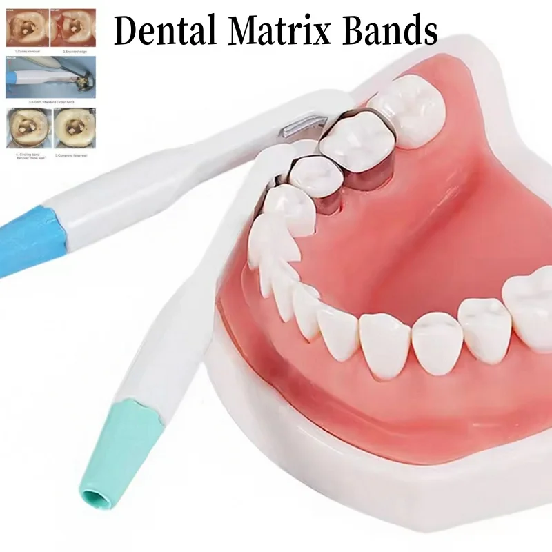 

Dental Matrix Band Matrice Adjustable Ring System Stainless Steel Curved Pre Formed 5/6MM Dentistry