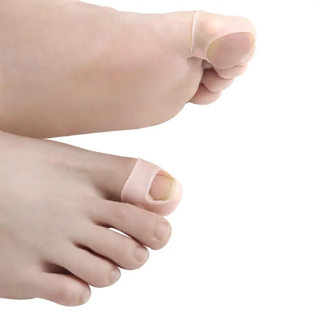 10 stuks ingegroeide teennagel corrector teennagel behandeling pedicure gereedschap beschermer