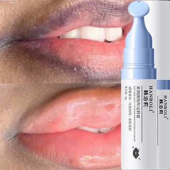 Lippen Roze Verse Lightening Bleekcrème Behandeling Verwijder Donkere Rook Lippen Lippenbalsem Whitening Vochtinbrengende Essentie