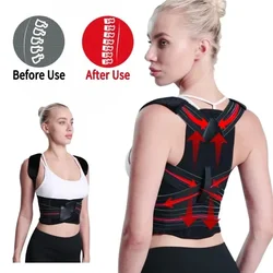 Men Posture Corrector Women Back Brace Upper Pain Relief Muscle Support Straightener Shoulder Neck Clavicle Spine Improves