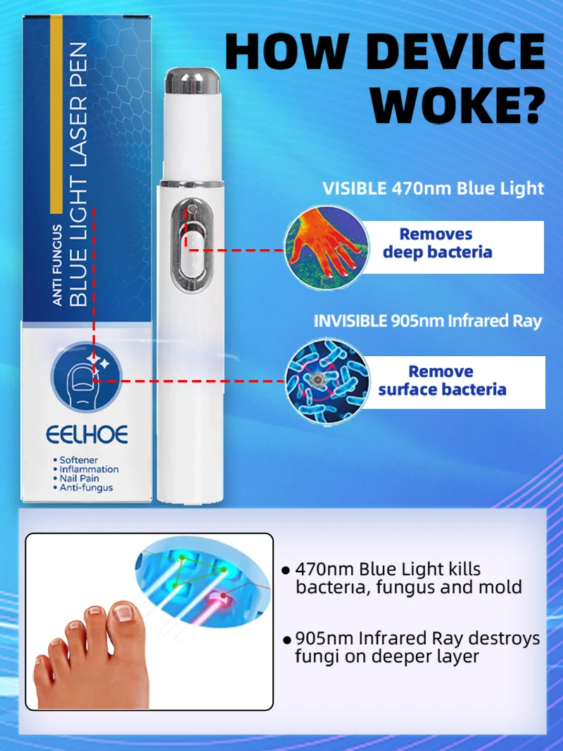 2025 Hot Sellers: Nail Cleaning Tools, Blue Light Laser Tools Root Repair Upgraded to Second Generation