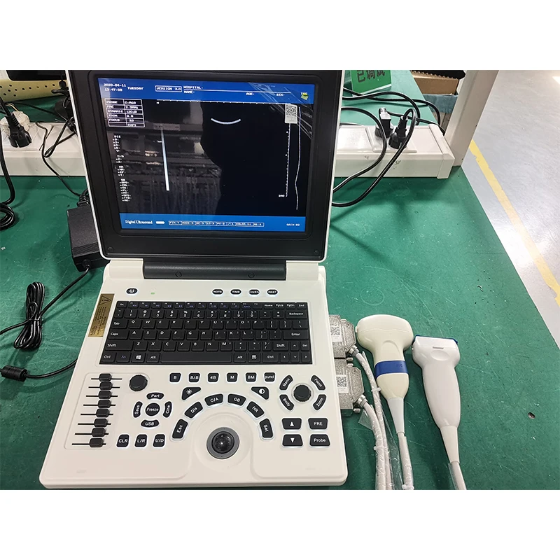 Rayman Medical Full Digital Electric Portable Laptop Color  Ultrasound Machine with 12