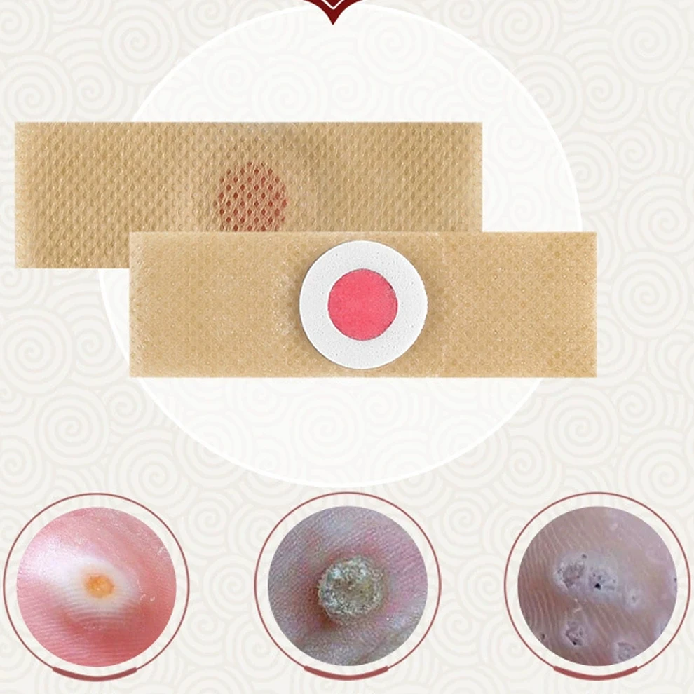 48 قطعة ملصق العناية بالقدم التصحيح الطبي منصات إزالة الذرة بقع العلاجية النسيج إزالة الكالس السموم الصيف العناية بالقدم التصحيح