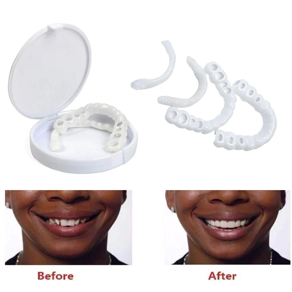 Sdotter Silicone Simulated Braces Upper/lower Dentures Veneers Perfect Veneers Dentures Paste Oral Hygiene Tool Cosmetic Dentist