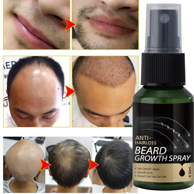 Beard Growth Spray 30ml Beard Growth Oil Nourishing Beard Hair Growth Oil Beard Growth Enhancer Liquid Natural Beard Care