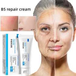 Crème réparatrice des rougeurs du visage B5, crème réparatrice des coups de soleil, apaisante, peau sensible, rosacée, démangeaisons, améliorer l'hydratation, soins cosmétiques