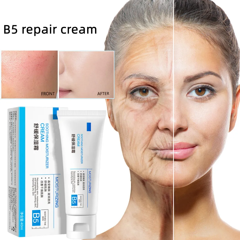 B5 Facial Redness Repair Cream Sunburn Repair Soothing Sensitive Skin Rosacea Itching Improve Moisturing Care Cosmetics