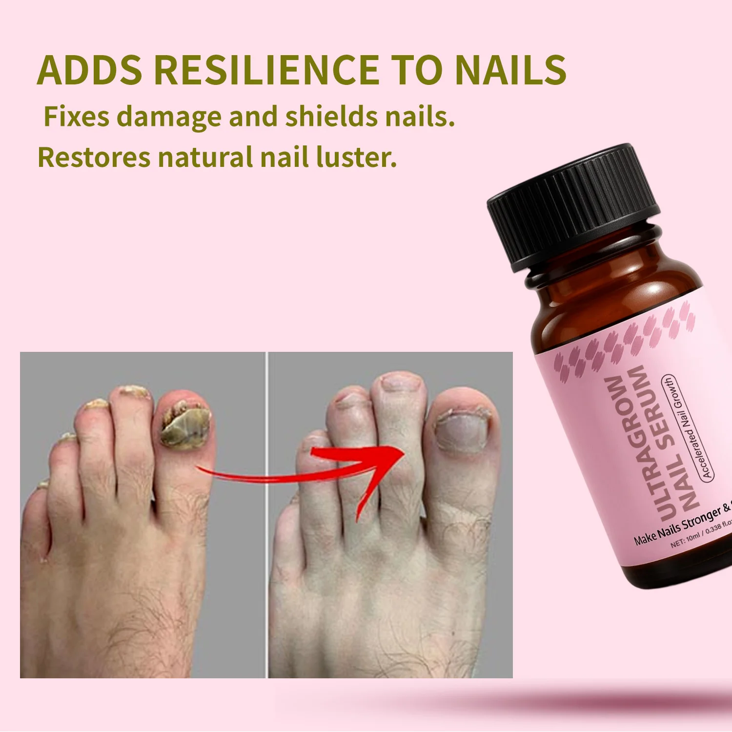 10ML UltraGrow Nail Serum for Growth and Strength with Keratin Complex Olive Oil & Vitamin E for Weak, Brittle, Splitting Nails