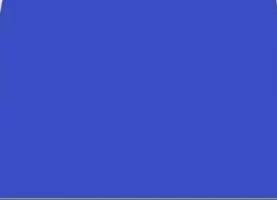 

5PCS Dental Scaler Tips Fit EMS Woodpecker Ultrasonic Scaler Handpiece Dental Ultrasonic Scaler Scaling Tip