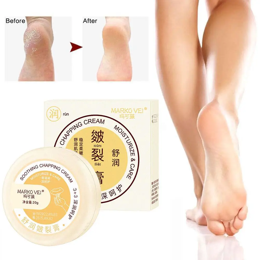 Crème réparatrice anti-séchage pour les pieds, soin de la peau, des mains et des pieds, élimination des fissures au talon, fréquence, 20g