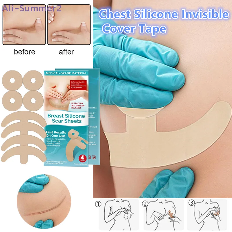 

【Summer2】Силиконовые гелевые невидимые наклейки-стикеры для маскировки шрамов и татуировок, круглые, в форме дуги, для груди, корректирующие дефекты кожи