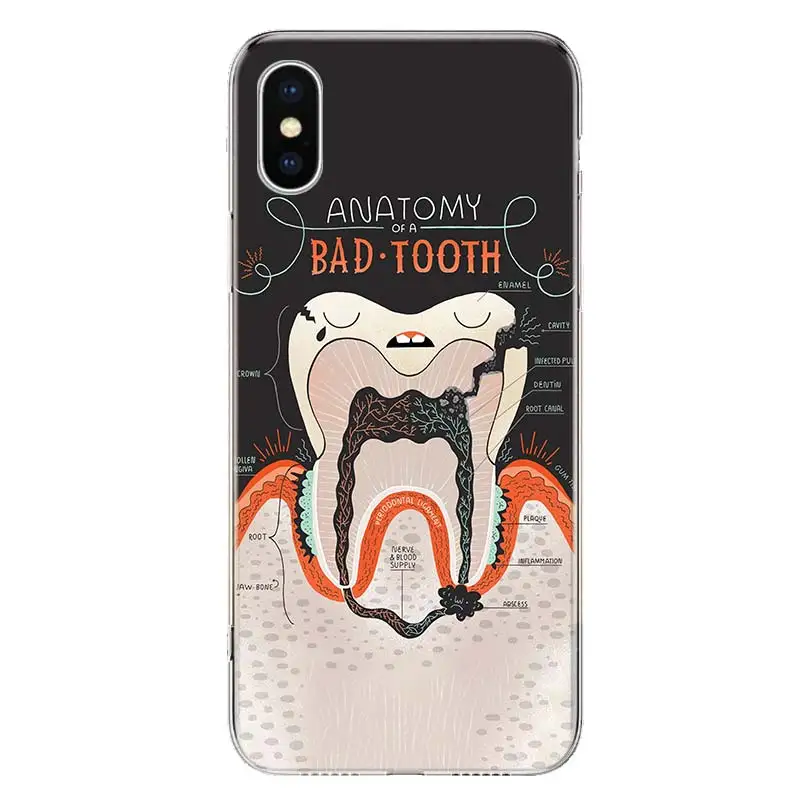 NEW ARRIVAL Dental anatomy bad tooth Phone Case For Apple iphone 16 15 14 13 12 11 Pro Max SE X XS XR 7 + 8 Plus Print Soft Cove