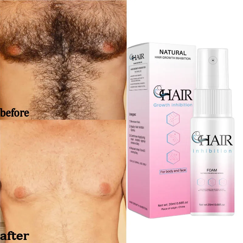 2 Minutes Fast Hair Removal Spray Painless Hair Growth Inhibitor Arm Armpit Leg Permanent Depilatory for Men Women Repair Care
