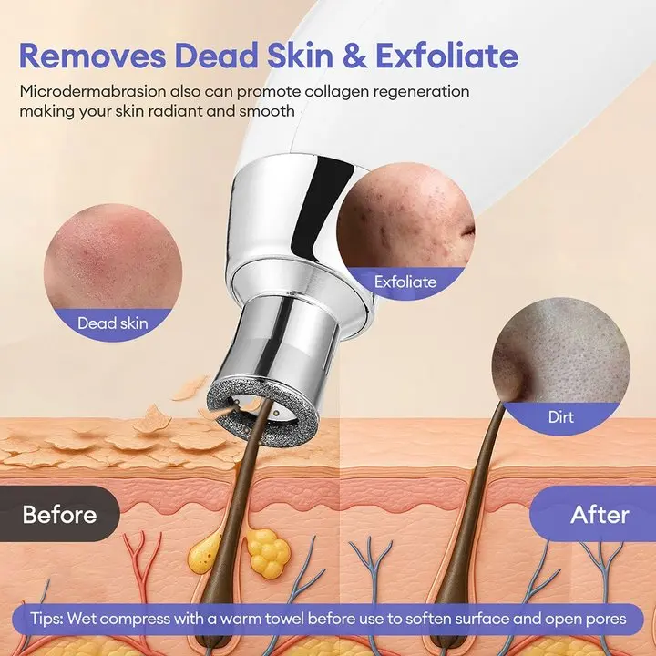 Draagbare Diamant Peeling Machine Microdermabrasie Facial Diepe Reiniging Huidverzorging Apparaat Peeling Vacuüm Mee-eter Remover