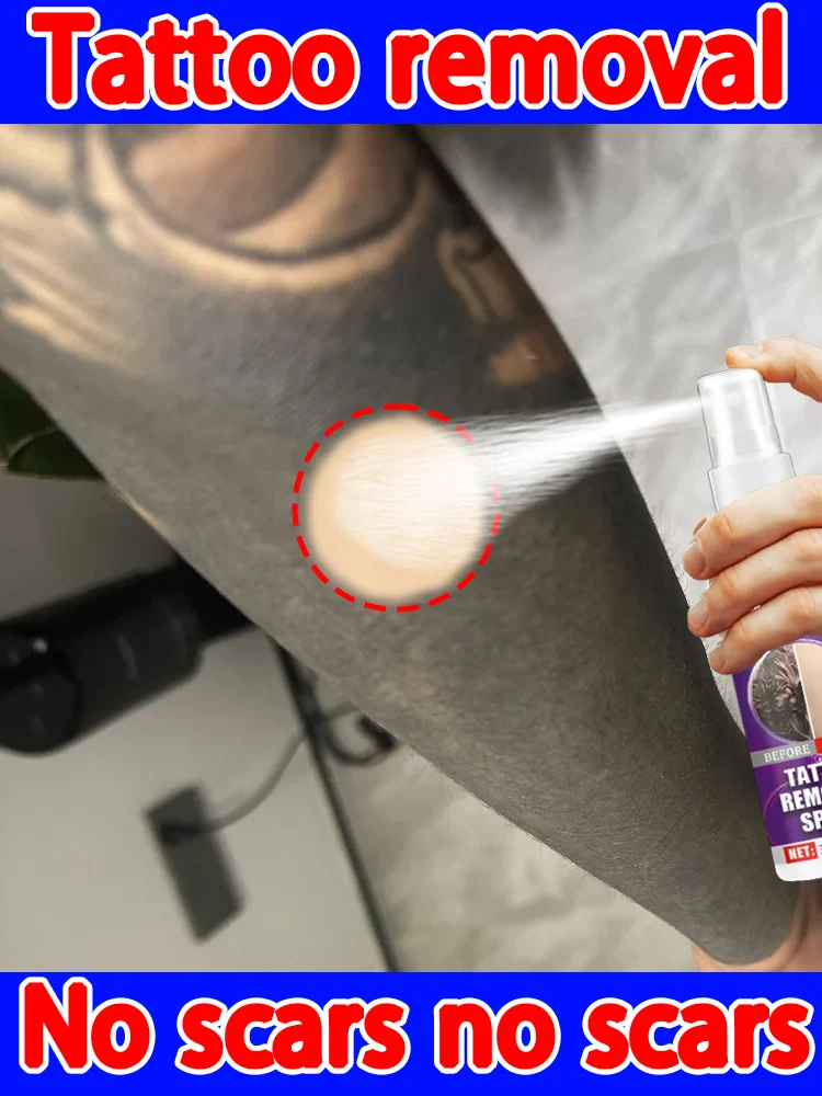 

Нет лазера, без боли, без шрамов, легкое удаление татуировок