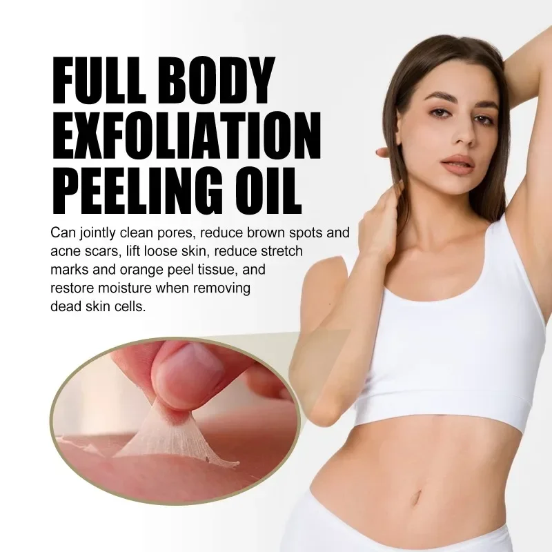 

Sdatter Yellow Peeling Oil Bleaching Remove Arm elbow Knee Legs Dark Melanin Body clean Brighten Exfoliating Dead Skin Care Whit