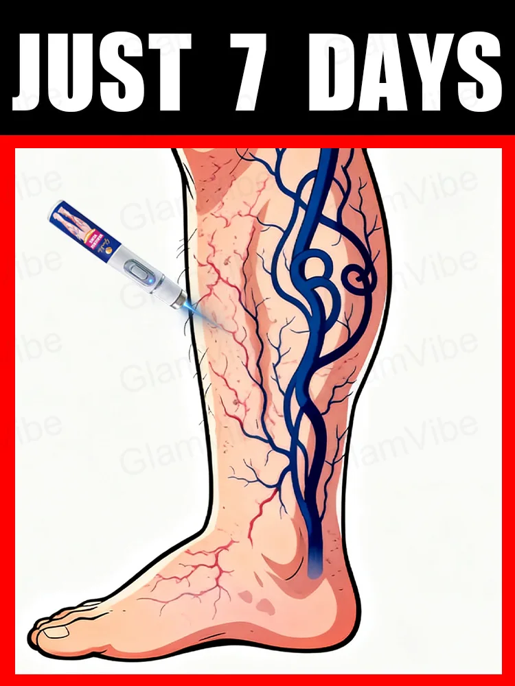 

2025 Hot Selling Blue Light Vein Tool, Say Goodbye to Varicose Veins