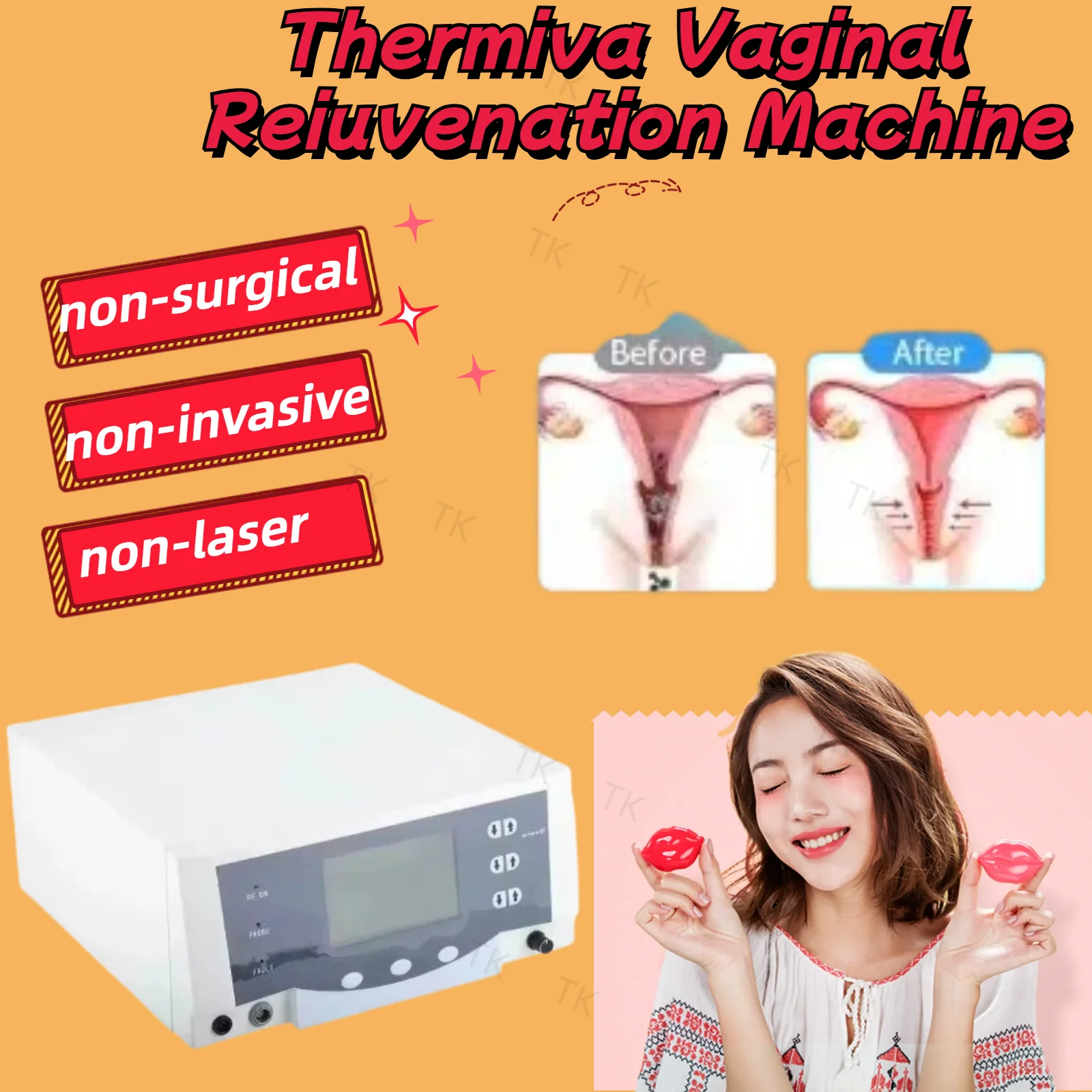 Thermiva vaginal tightening machine, Thermi vaginal regeneration, private care, tightening and repairing, spa salon, women's pri